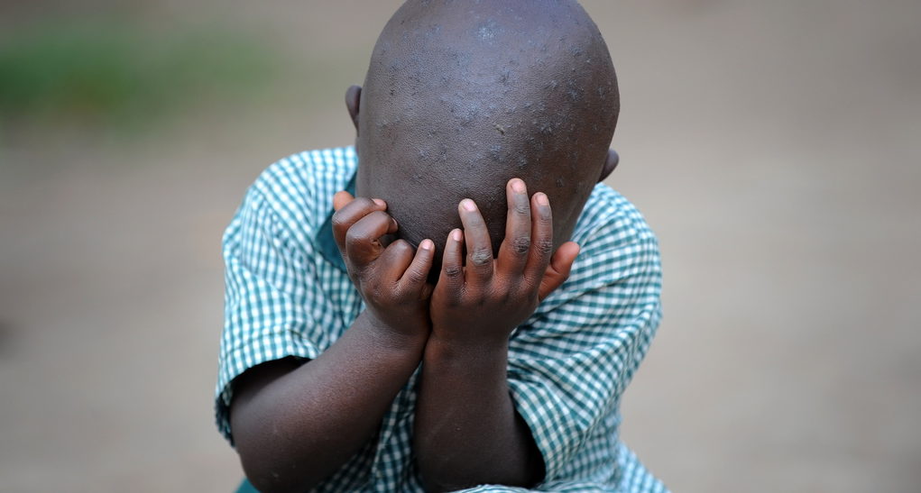 Ein trauriges Kind in Uganda. (Quelle: Alexander Volkmann)
